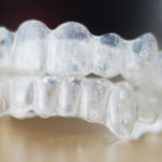 pair of clear aligners to straighten teeth